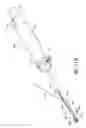 Fig. 86 - Tissue anchoring system for percutaneous glossoplasty