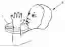 Fig. 01 - Device for preventing finger sucking, particularly for babies