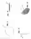 Fig. 07 - Structurally supportive horseshoe and method for fitting
