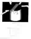 Fig. 06 - Thermally stable polycrystalline diamond cutting elements and bits incorporating the same