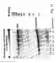 Fig. 09 - Gel for electrophoresis