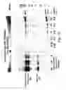 Fig. 10 - Gel for electrophoresis