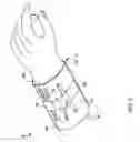 Fig. 04 - Hands-free forearm carrier of articles