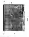 Fig. 04 - Interfacial composite structure and method of making them