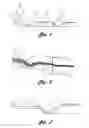 Fig. 02 - High-speed, precision, laser-based method and system for processing material of one or more targets within a field