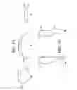 Fig. 15 - Backpack frame system
