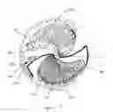Fig. 20 - Advanced gestational wheel calculator