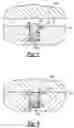 Fig. 07 - High speed rotating atomizer assembly