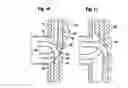 Fig. 09 - Cooled furnace wall