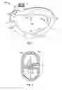 Fig. 02 - Bag holder