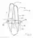 Fig. 02 - Device for carrying objects