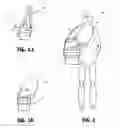 Fig. 03 - Car seat carrier