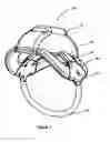 Fig. 03 - Magnetic resonance reception coil composite structure