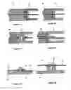 Fig. 06 - Magnetic resonance reception coil composite structure