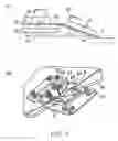 Fig. 02 - Inspection probe