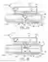 Fig. 04 - Liquid level sensor switch