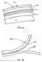 Fig. 06 - Computer mouse cover