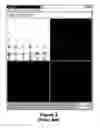 Fig. 03 - Toboggan-based method for automatic detection and segmentation of objects in image data