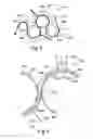 Fig. 07 - Microreplicated article with moire reducing surface