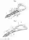 Fig. 02 - Head suspension with rails and support extensions