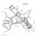 Fig. 10 - Elastic flashlight fastner
