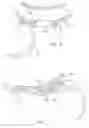 Fig. 06 - Holding apparatus for buckets