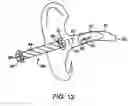 Fig. 09 - Remote magnetic activation of hearing devices