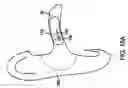 Fig. 17 - Remote magnetic activation of hearing devices