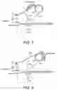 Fig. 06 - Fixing device of image forming apparatus