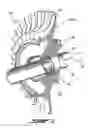 Fig. 03 - Eddy current heating for reducing transient thermal stresses in a rotor of a gas turbine engine