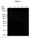 Fig. 12 - Cytotoxicity mediation of cells evidencing surface expression of CD63