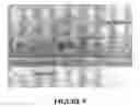 Fig. 05 - Functionally graded biocompatible coating and coated implant