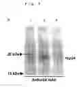 Fig. 04 - Recombinant BCG vaccine