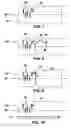 Fig. 05 - Seeding implantable medical devices with cells