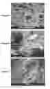 Fig. 05 - RESORBABLE STRUCTURE FOR TREATING AND HEALING OF TISSUE DEFECTS