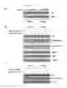 Fig. 12 - Beta-parvin expression for use in diagnostic methods for assessment of breast cancer