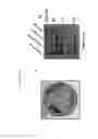 Fig. 13 - Beta-parvin expression for use in diagnostic methods for assessment of breast cancer