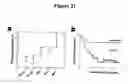 Fig. 113 - Expression profile of prostate cancer