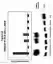Fig. 116 - Expression profile of prostate cancer