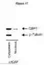 Fig. 129 - Expression profile of prostate cancer