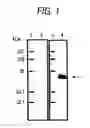 Fig. 02 - Protein which binds to Akt2