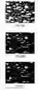 Fig. 22 - Device for aggregating, imaging and analyzing thrombi and a method of use