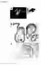 Fig. 11 - Human trophoblast stem cells and use thereof