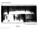 Fig. 10 - Method and system for introducing a gene into a human stem cell