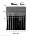 Fig. 12 - Modulation of hedgehog-mediated signaling pathway