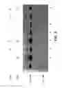 Fig. 13 - Modulation of hedgehog-mediated signaling pathway
