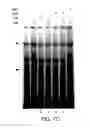 Fig. 16 - Modulation of hedgehog-mediated signaling pathway