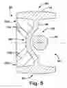 Fig. 06 - Axle assembly
