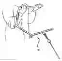 Fig. 01 - Universal handlebar for exercise equipment