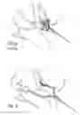 Fig. 05 - Universal handlebar for exercise equipment